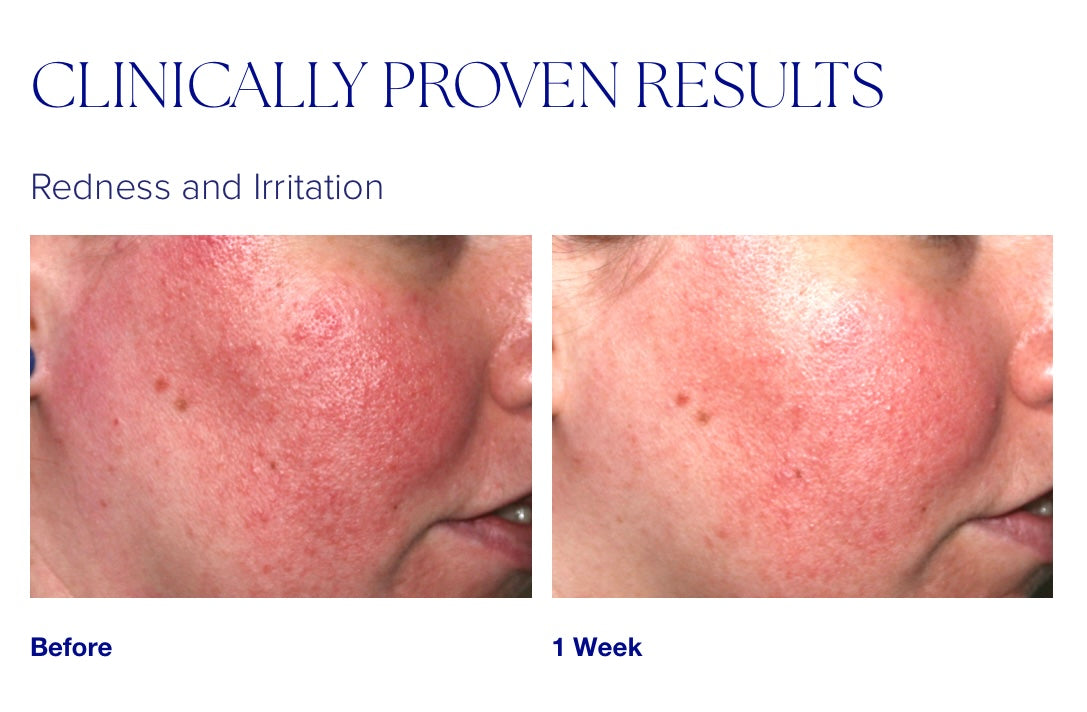 iS Clinical Pro-Heal Serum