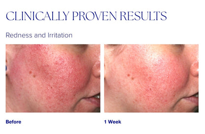 iS Clinical Pro-Heal Serum