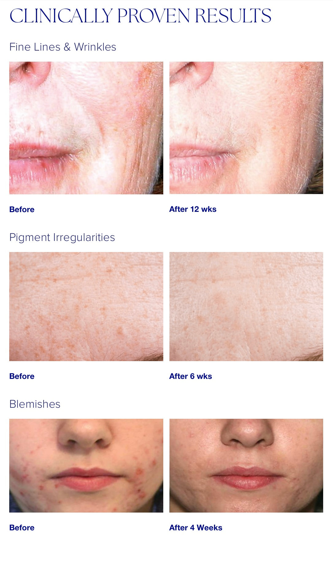 iS Clinical Active Serum
