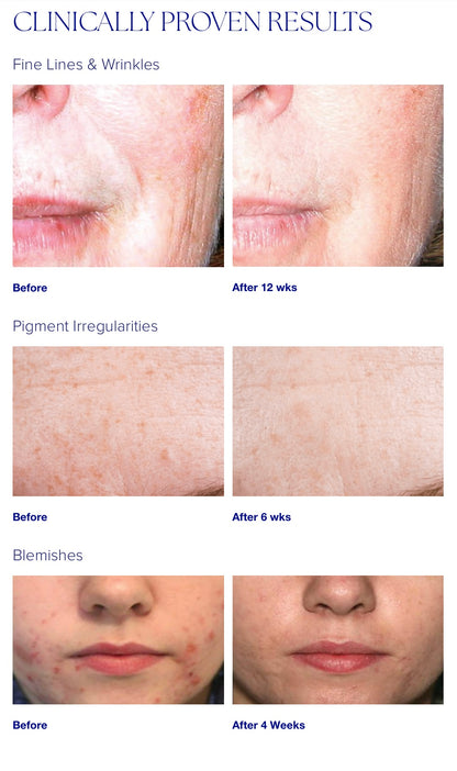 iS Clinical Active Serum