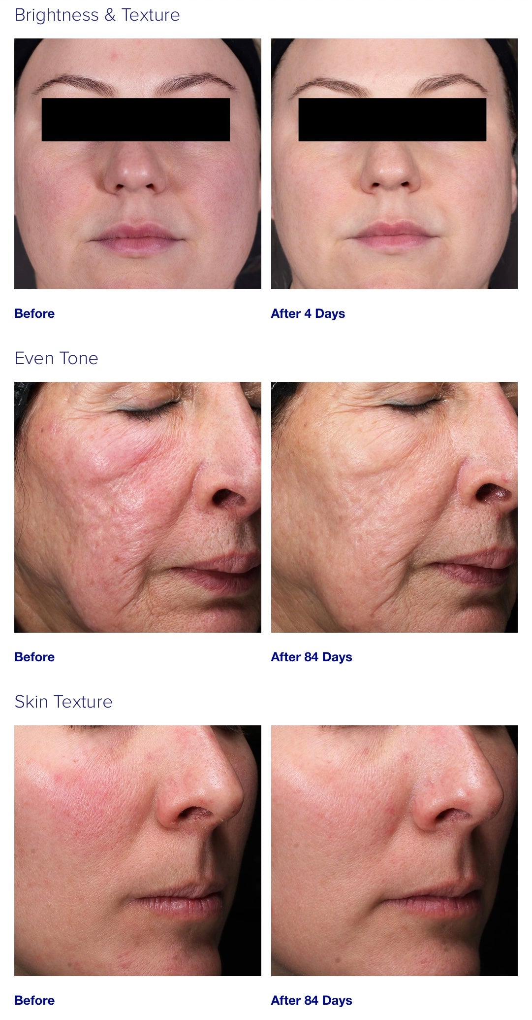 iS Clinical Retinol Emulsion 0.3%