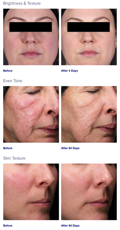 iS Clinical Retinol Emulsion 0.3%